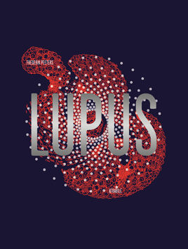 Lupus « intégrale »